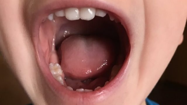 Featured Image For New Year, New Teeth! – Teething 101