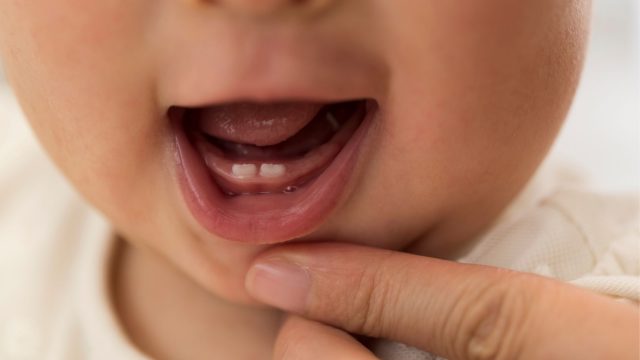 Featured Image For Infant Oral Health Care